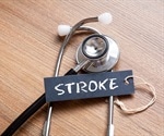 Study finds 10 metabolites associated with risk of stroke