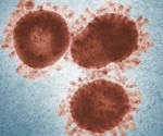 Australian scientists grow live coronavirus virus