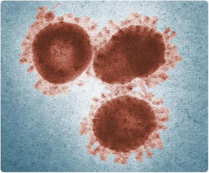 These are coronaviruses (colored transmission electron microscopy image). Image Credit: Photo: Dr. Fred Murphy & Sylvia Whitfield/CDC