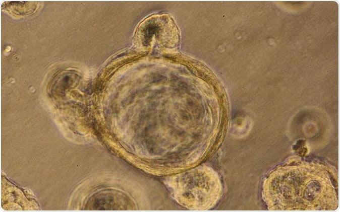 This is a mini-gut organoid generated in the lab from human stem cells. Image Credit: UC San Diego Health Sciences