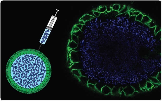 Schematic representation of the injection of bacteria into the lumen of an organoid, and a fluorescent microscopy image of such an organoid. Human intestinal organoid (green) filled with labeled bacteria (blue). Image Credit: Cayetano Pleguezuelos-Manzano, Jens Puschhof, Axel Rosendahl Huber, ©Hubrecht Institute