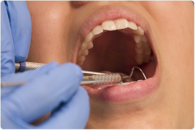 Dental exam. Image Credit: American Heart Association