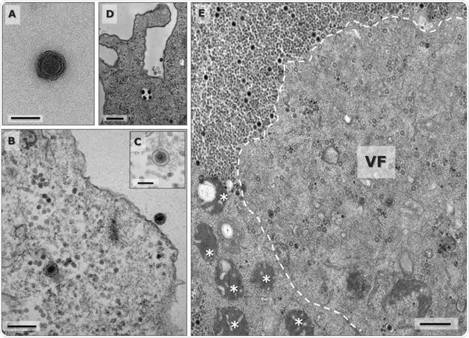 Yaravirus particle and the beginning of the viral cycle. a Negative staining of an isolated Yaravirus virion. Scale bar 100nm. b Transmission electron microscopy (TEM) representing the beginning of the viral cycle, in which one particle is associated to the host cell membrane and the second one was already incorporated by the amoeba inside an endocytic vesicle. Scale bar 200nm. c Detailed image of an incorporated Yaravirus particle in the interior of an endocytic vesicle. Scale bar 100nm. d Viral uptake by the amoeba may occur individually but also in groups of particles, as observed in the micrograph. Scale bar 250nm. e The viral factory completely develops occupying the nuclear region and recruiting mitochondria around it. Two different regions can be distinct: an electron-lucent region where the virions are assembled as empty shells and a second region formed by several electron-dense points where the genome is packaged inside the particles. Scale bar 500nm.