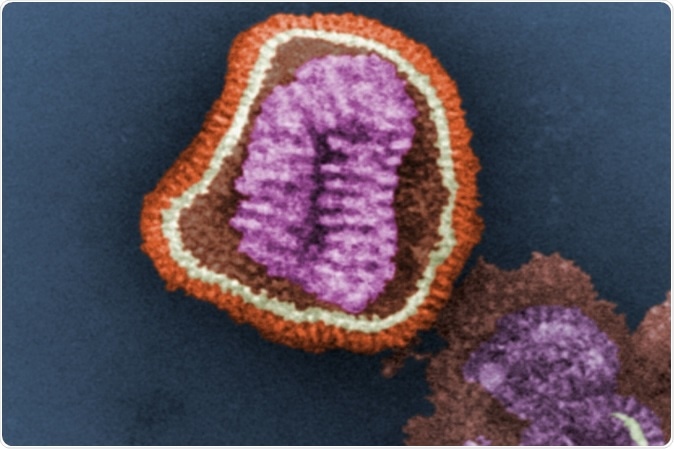 This digitally-colorized transmission electron microscopic image depicts the ultrastructural details of an influenza virus particle. Image: CDC, Frederick Murphy