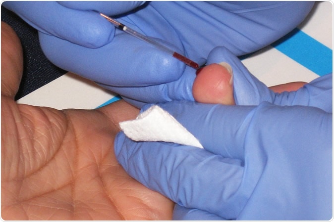 Cholesterol test - Drawing blood from the finger to use in a cholesterol test. Copyright American Heart Association