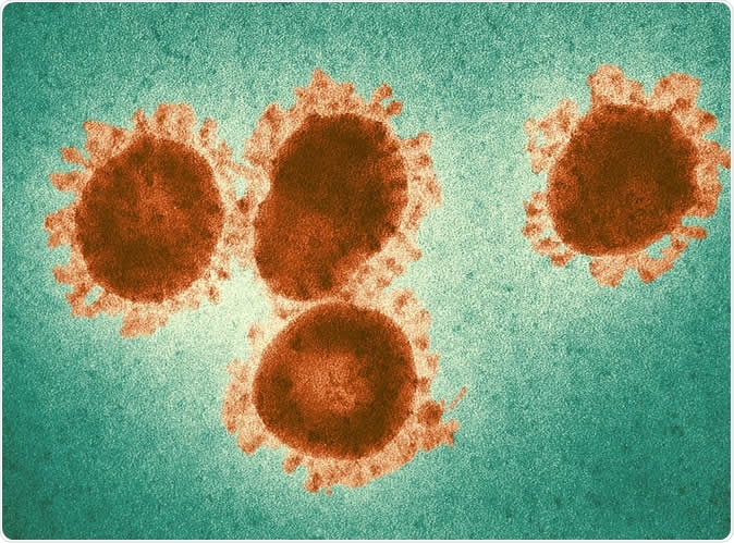 Coronaviruses, which include the MERS and SARS pathogens, are characterized by a wreath of coat proteins that can be seen on microscope images. / Photo: CDC / Fred Murphy
