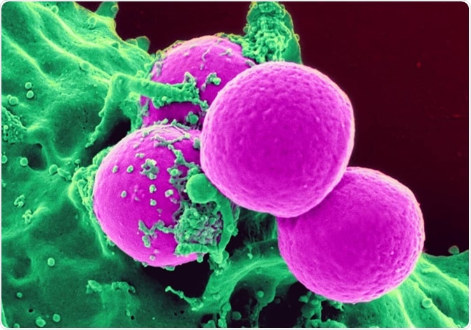 Staphylococcus aureus colony. Image Credit: Ebrahim Lotfi / Shutterstock
