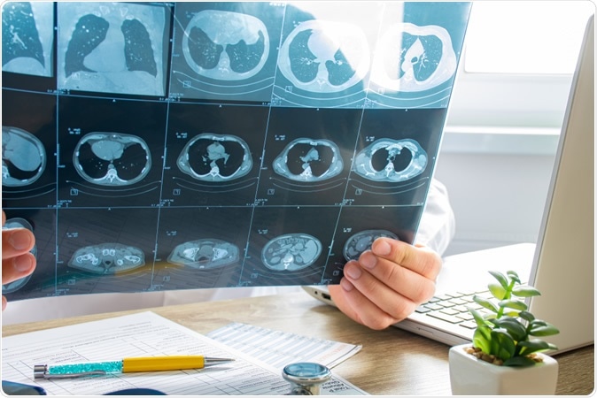 CT scan of chest and abdominal cavity. Image Credit: Shidlovski / Shutterstock