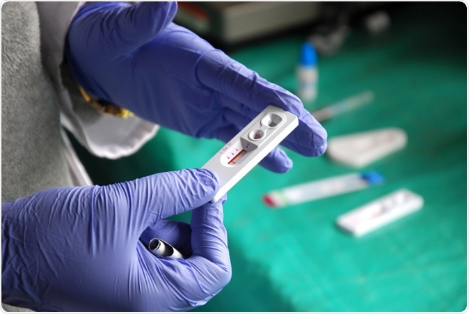 HIV test. Image Credit: Franco Volpato / Shutterstock