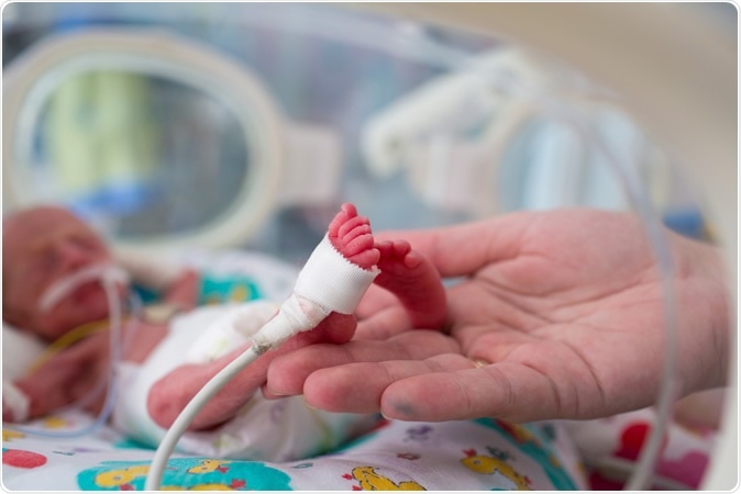 Premature baby. Image Credit: Kristina Bessolova / Shutterstock