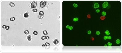 Bright-field image (left) shows the variable morphology of primary hepatocytes. Dual fluorescence image (right) shows counted live hepatocytes (circled in green) and counted dead hepatocytes (circled in red).