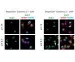 Peptigel Hydrogels Mimic Healthy and Tumor Tissue Properties