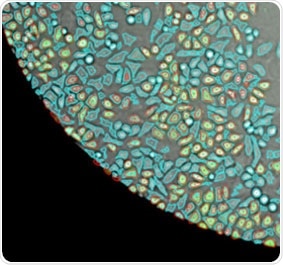 Brightfield image of a well on a 96-well microplate showing counted adherent cells.