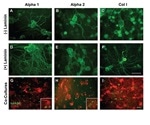 Peptigel Hydrogels Improve Neurotrophic Potential of hADSCs