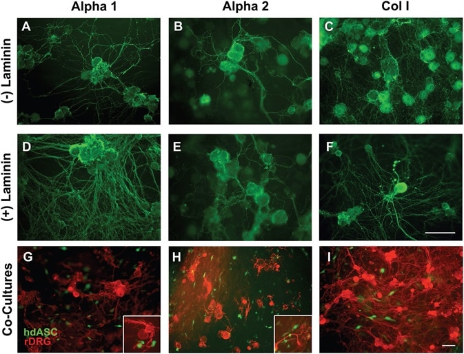 Alpha 1 and Alpha 2 are suitable substrates for neuronal cultures allowing neurite outgrowth without the need of biological ECM coatings. A–C) Rat DRG neurons successfully attached to Alpha 1 and Alpha 2 hydrogels, without any need of laminin coating, which is normally a requirement for any nonbiological substrate. A dense network of neurites was observed on both SAPs and on Col I control gels. D–F) When laminin precoating was applied, the density of the neurite network was increased on all substrates. G–I) Successful cocultures of hdASC and rat DRG neurons were established on all substrates, and close interactions between neuronal extensions and hdASC were observed (see higher magnification inserts). Scale bars 100 μm.