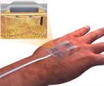 Scientists develop "smart" remote-control bandage for chronic wounds