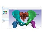 Synopsys introduces automated segmentation tool for hips and knees