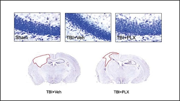 Dampening effects of overactive immune cells may serve as new treatment for TBI