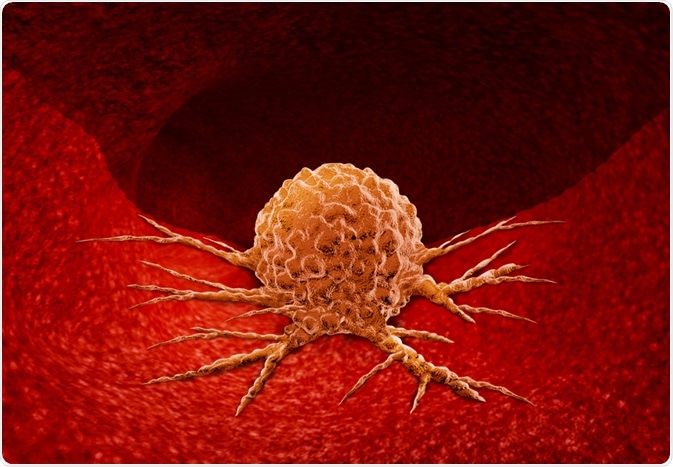 Tumor Cell