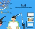 Transcranial Magnetic Stimulation Therapy for Depression