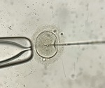 First baby born from frozen immature eggs matured in the lab