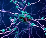 What are the Types of Neuroinflammation?