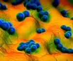 Newly discovered antibiotics kill bacteria differently