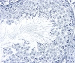 Spermatogenesis Biomarkers