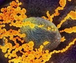 Drug for Ebola and MERS effective against COVID-19