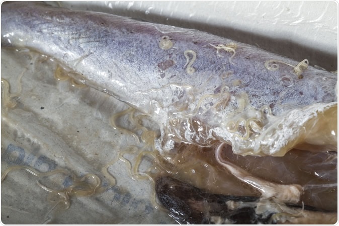 Anisakis worms in blue whiting fish. The prevalence of these worms, found in raw or undercooked fish, has increased dramatically since the 1970s. Image Credit: Gonzalo Jara / Shutterstock