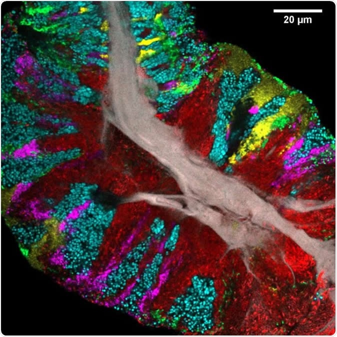 Bacterial biofilm scraped from the surface of the tongue and imaged using CLASI-FISH. Human epithelial tissue forms a central core (gray). Colors indicate different bacteria: Actinomyces (red) occupy a region close to the core; Streptococcus (green) is localized in an exterior crust and in stripes in the interior. Other taxa (Rothia, cyan; Neisseria, yellow; Veillonella, magenta) are present in clusters and stripes that suggest the growth of the community outward from the central core. Image Credit: Steven Wilbert and Gary Borisy, The Forsyth Institute
