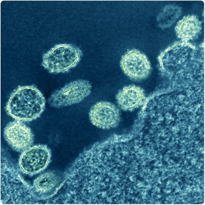 1918 H1N1 Virus Particles. Electron micrograph of 1918 H1N1 influenza virus particles near a cell. Credit: NIAID