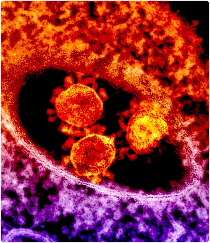 'MERS Coronavirus Particles