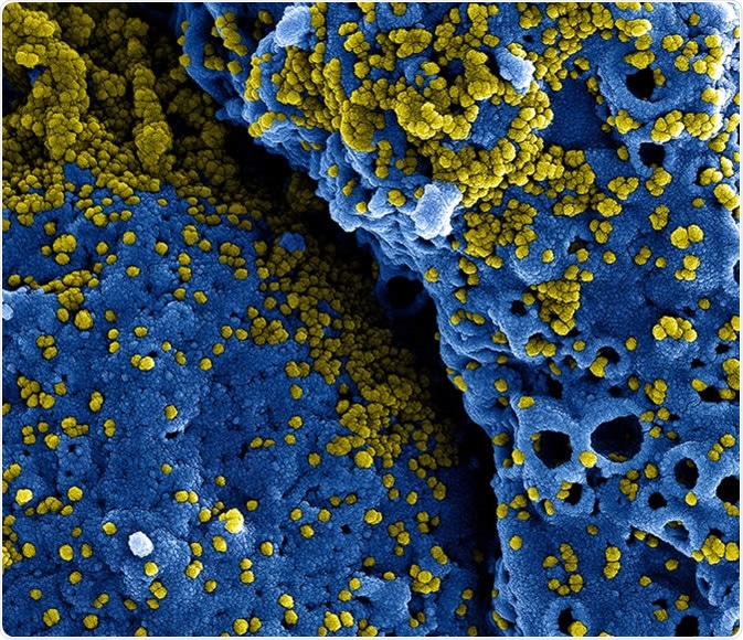 MERS Coronavirus Particles Colorized scanning electron micrograph of MERS virus particles (yellow) both budding and attached to the surface of infected VERO E6 cells (blue). Image captured and color-enhanced at the NIAID Integrated Research Facility in Fort Detrick, Maryland. Credit: NIAID