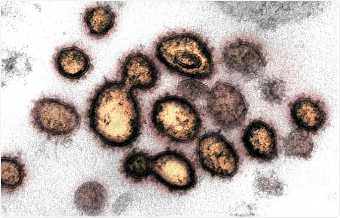 Novo imagem do microscópio de elétron da transmissão de Coronavirus SARS-CoV-2 esta mostra SARS-CoV-2, o vírus que causa COVID-19, isolado de um paciente no vírus que dos E.U. as partículas são mostradas emergir da superfície das pilhas cultivadas no laboratório. Os pontos na borda exterior das partículas do vírus dão a coronaviruses seu nome, coroa-como. Crédito: NIAID-RML