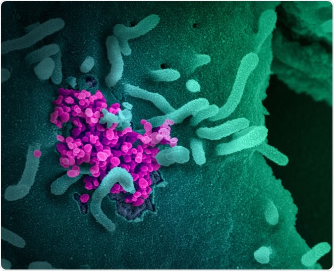 Novel Coronavirus SARS-CoV-2 This scanning electron microscope image shows SARS-CoV-2 (round magenta objects) emerging from the surface of cells cultured in the lab. SARS-CoV-2, also known as 2019-nCoV, is the virus that causes COVID-19. The virus shown was isolated from a patient in the U.S. Credit: NIAID-RML
