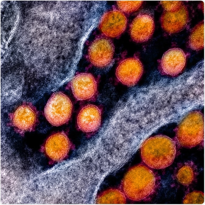 Novel Coronavirus SARS-CoV-2 - Transmission electron micrograph of SARS-CoV-2 virus particles, isolated from a patient. Image captured and color-enhanced at the NIAID Integrated Research Facility (IRF) in Fort Detrick, Maryland. Credit: NIAID