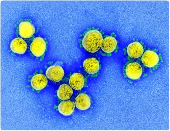 Coronavirus nuevo SARS-CoV-2: Esta imagen del microscopio electrónico de exploración muestra SARS-CoV-2 (objetos redondos del oro) que emerge de la superficie de las células cultivadas en el laboratorio. Haber: NIAID-RML