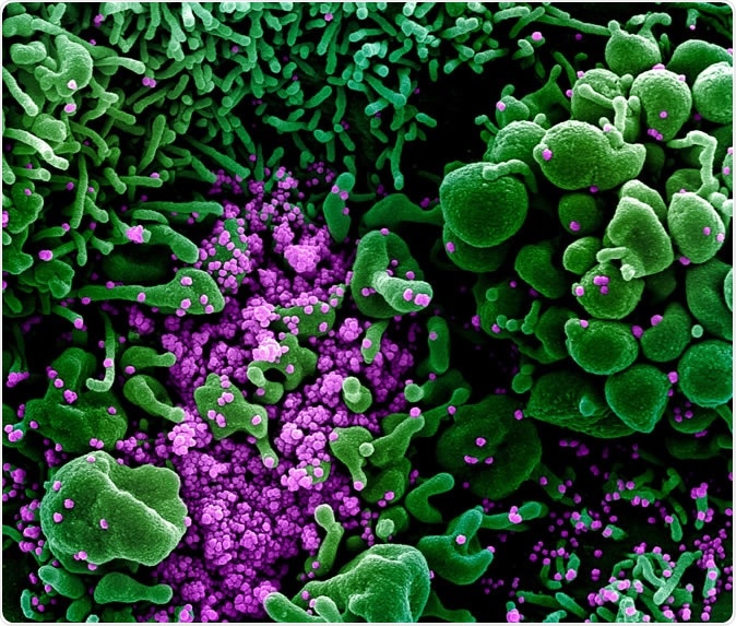 Micrográfo de electrón nuevo de la exploración de Coronavirus SARS-CoV-2 Colorized de una célula apoptotic (verde) infectada pesado con las partículas del virus SARS-COV-2 (púrpuras), aisladas de una muestra paciente. La imagen capturada y color-aumentada en el NIAID integró el centro de investigación en el fuerte Detrick, Maryland. Haber: NIAID
