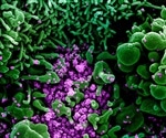 KHN’s ‘What the Health?’: Coronavirus goes viral