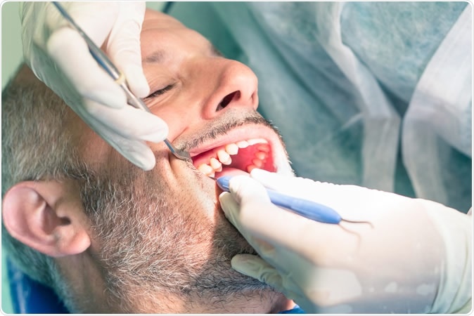 Are patient-reported pain and satisfaction scores similar between opioid users and nonopioid users after routine or surgical dental extractions? Image Credit: View Apart