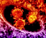 Mechano-immunological response to SARS-CoV-2