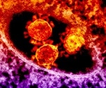 Australia reports first human-to-human coronavirus transmission, total cases now 39