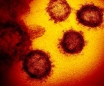 Evidence SARS virus may spread through the air