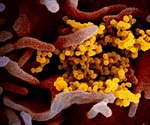 CSIRO begins key research on novel coronavirus
