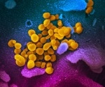 Evidence SARS virus may spread through the air