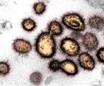 Researchers show how investigational antiviral drug stops coronavirus