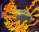 Newly discovered virus, New Haven coronavirus