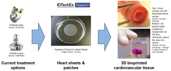 New 3D bioprinting technologies to create cardiovascular tissue