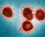 Testing for the SARS coronavirus by using a patients tear drops